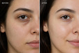 Before and after using AirCool Rested Eyes patches