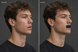 Before and after using AirCool Quiet Night mouth tape